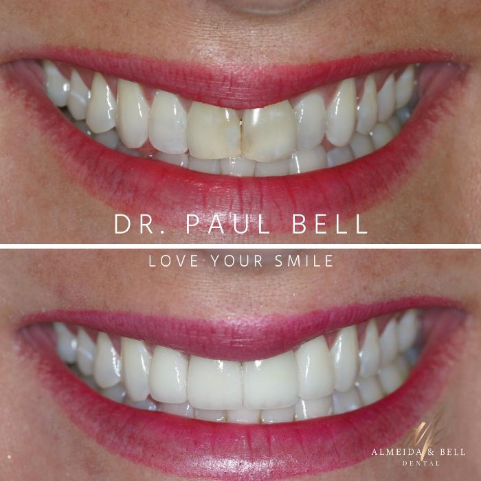 Almeida & Bell Dental Lone Tree - General, Cosmetic, and Implant Dentistry Image