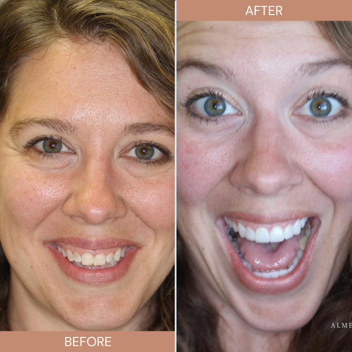 Almeida & Bell Dental Lone Tree - General, Cosmetic, and Implant Dentistry Image