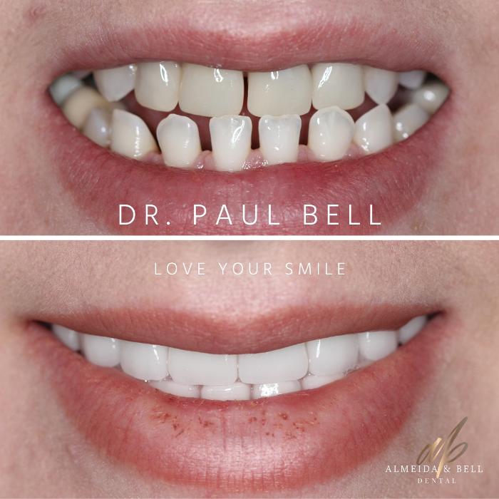 Almeida & Bell Dental Lone Tree - General, Cosmetic, and Implant Dentistry Image