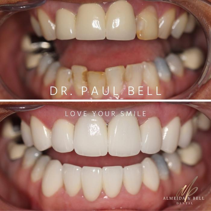 Almeida & Bell Dental Lone Tree - General, Cosmetic, and Implant Dentistry Image