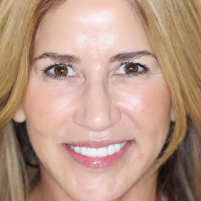 Almeida & Bell Dental Lone Tree - General, Cosmetic, and Implant Dentistry Image