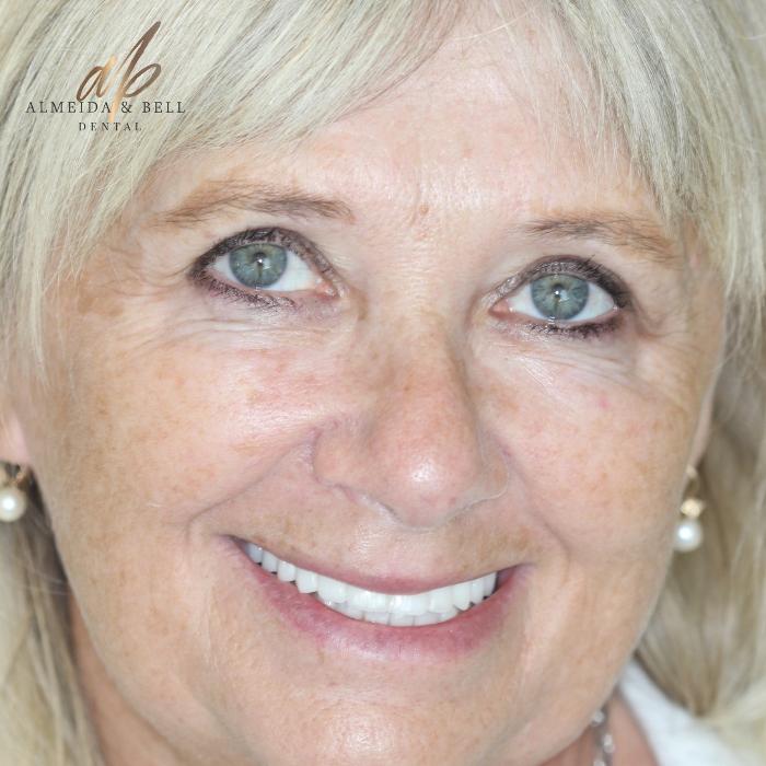 Almeida & Bell Dental Lone Tree - General, Cosmetic, and Implant Dentistry Image