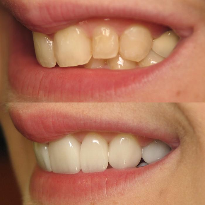 Future of Dentistry - Dracut Image