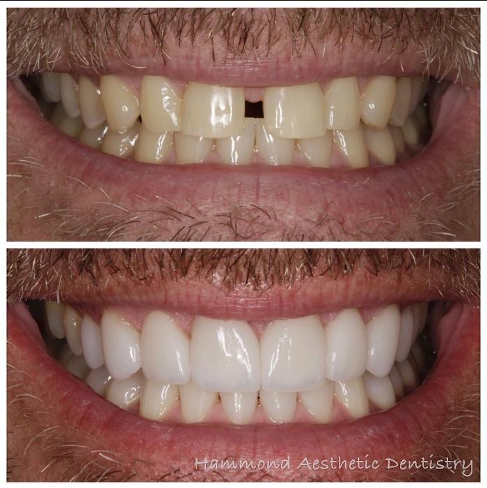 Hammond Aesthetic & General Dentistry Image