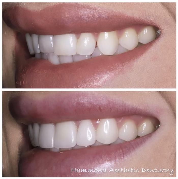 Hammond Aesthetic & General Dentistry Image