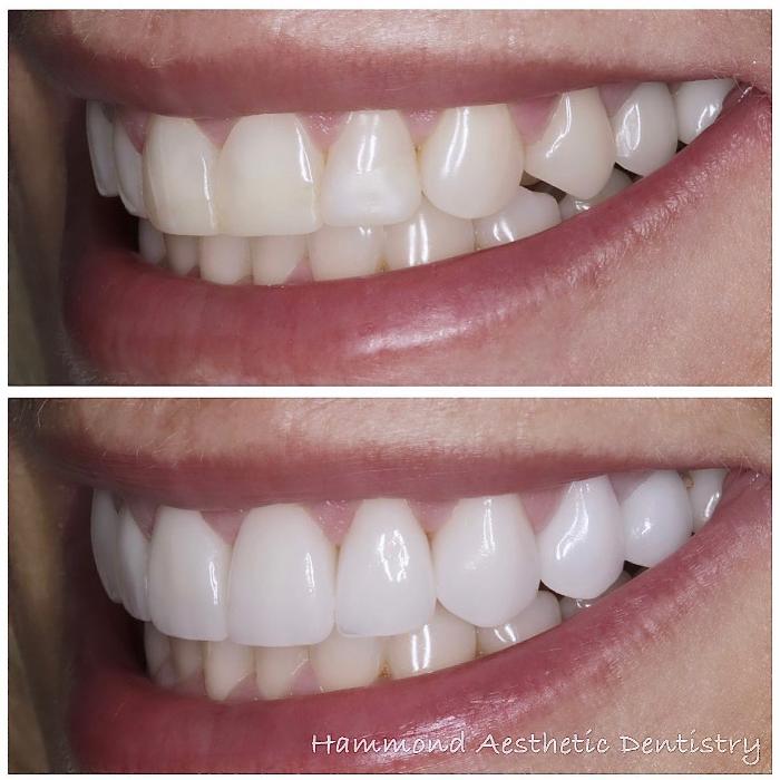 Hammond Aesthetic & General Dentistry Image