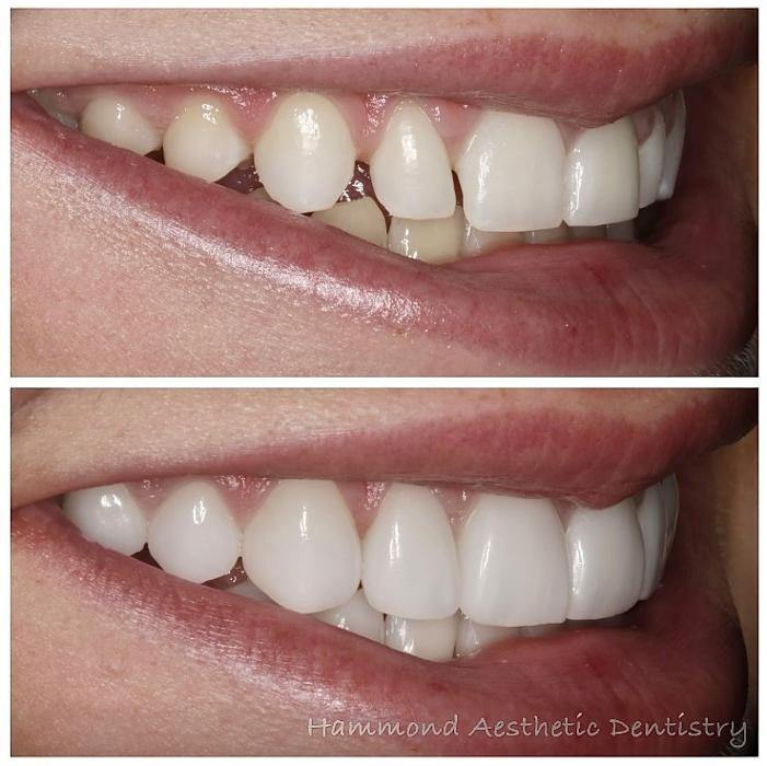 Hammond Aesthetic & General Dentistry Image