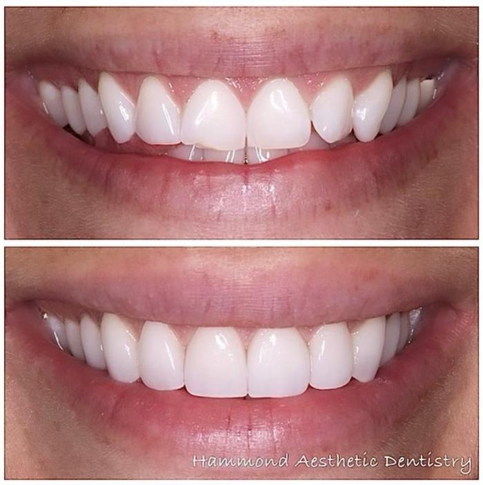 Hammond Aesthetic & General Dentistry Image