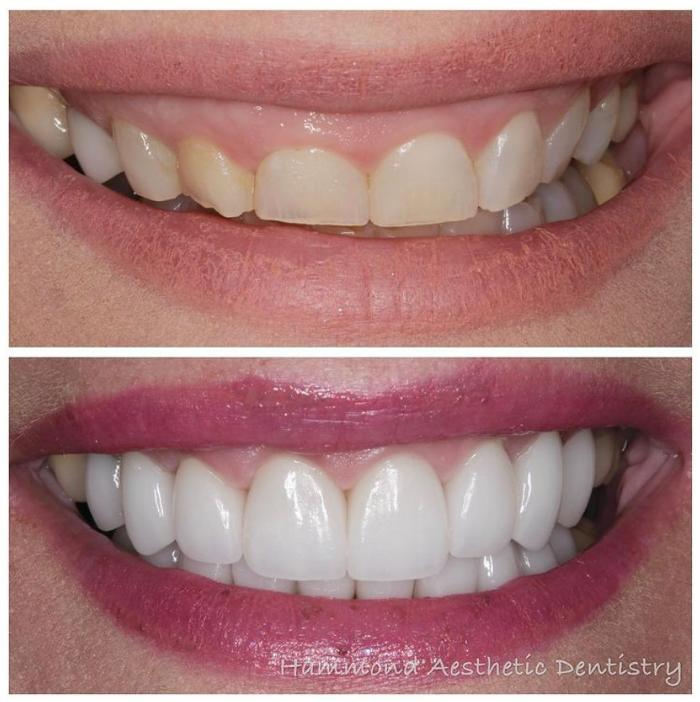 Hammond Aesthetic & General Dentistry Image