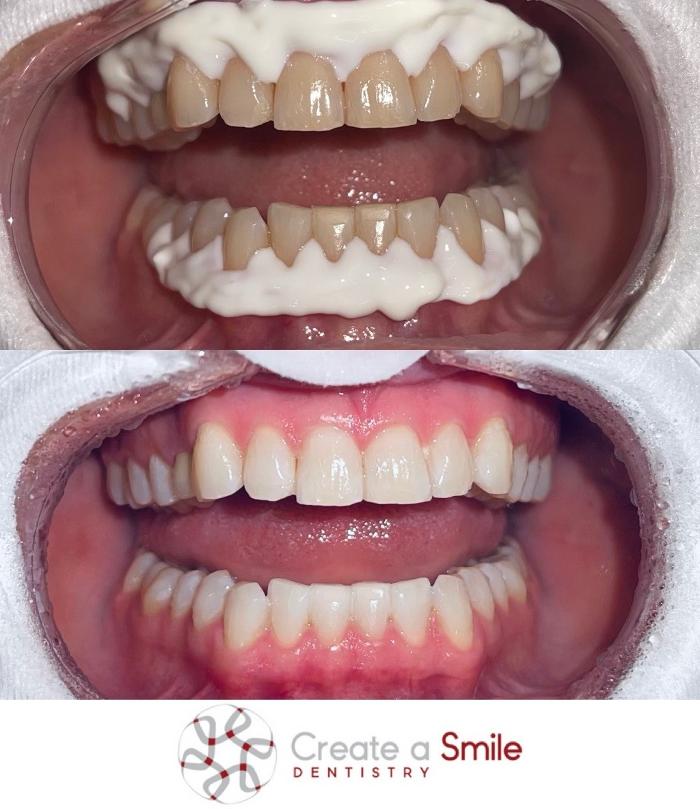 Create A Smile Dentistry - Dr. Ken Moore Logo