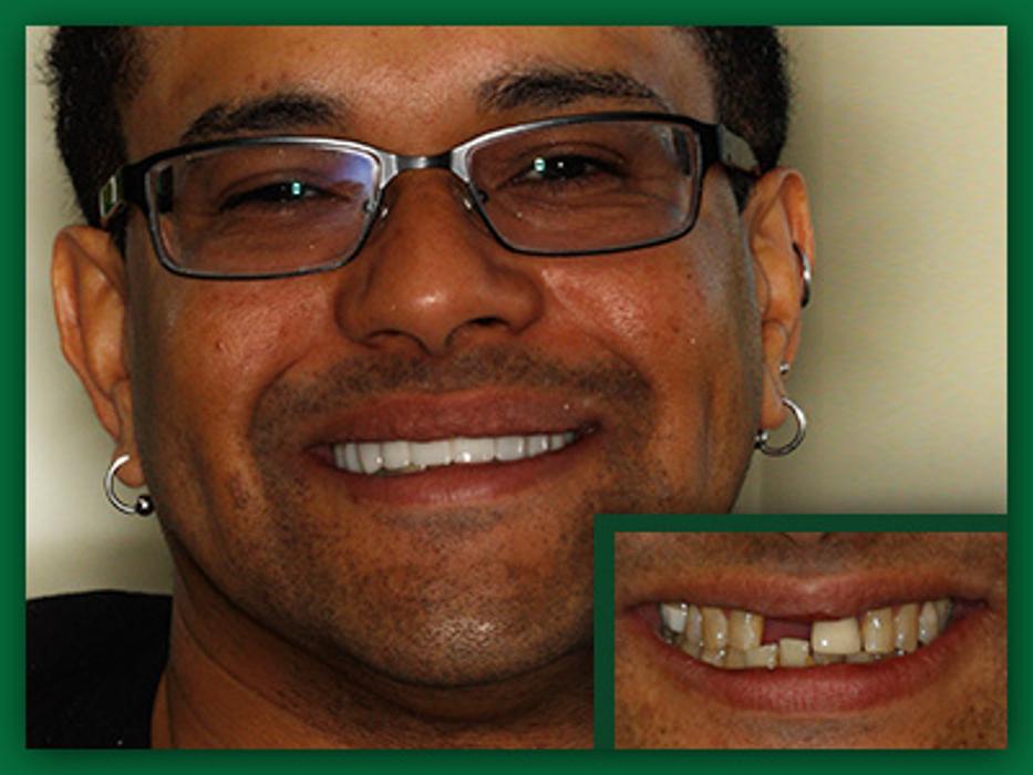 Jefferson City Dental Care Image