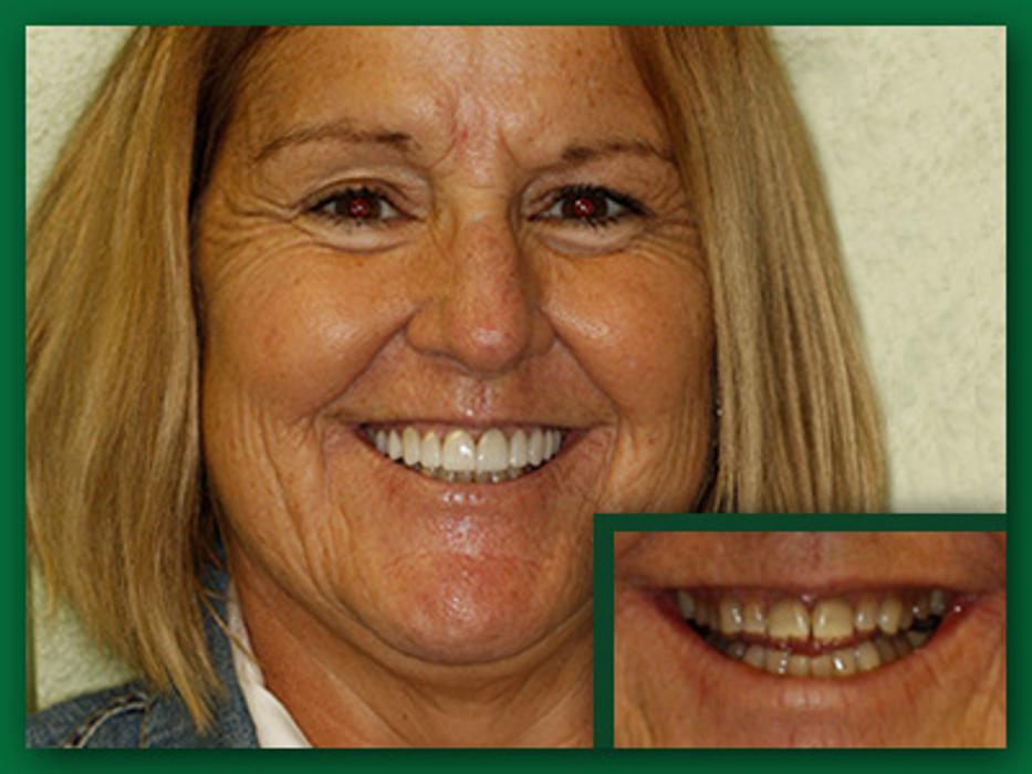 Jefferson City Dental Care Image