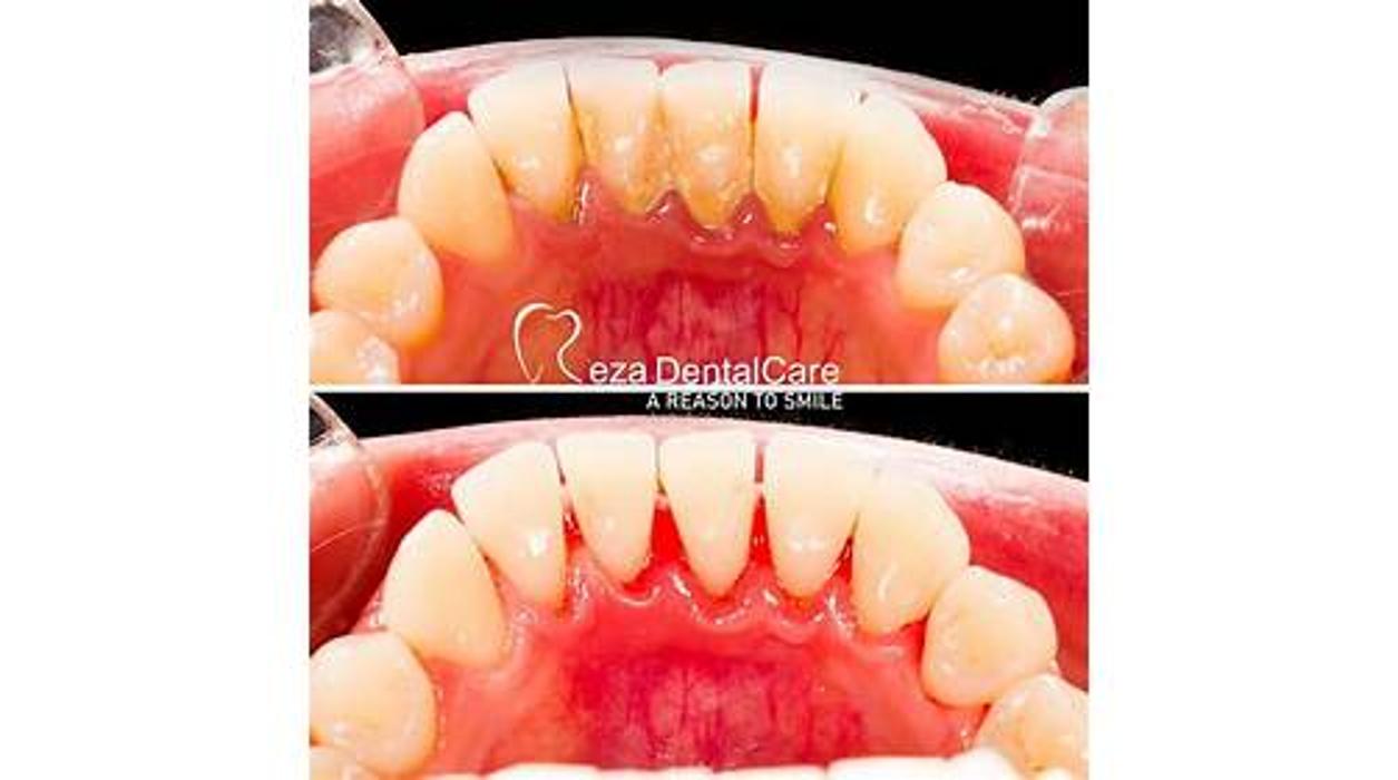 Reza Dental Care - South Gate, CA