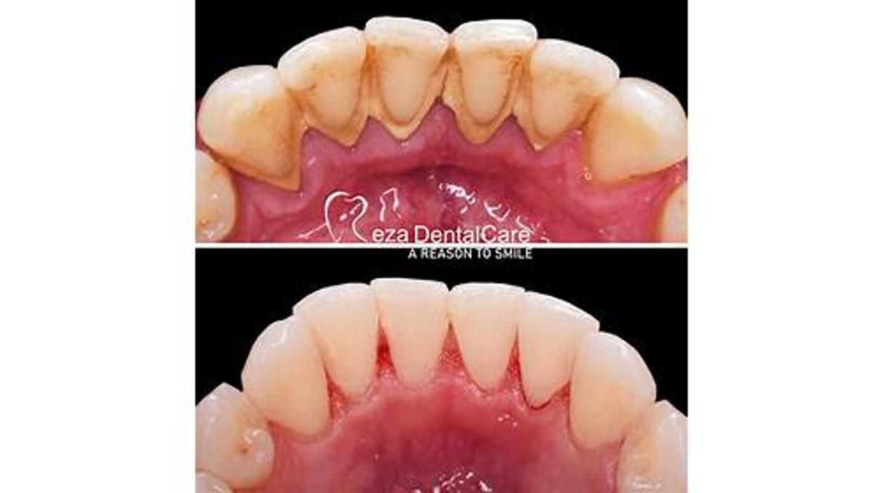 Reza Dental Care - South Gate, CA