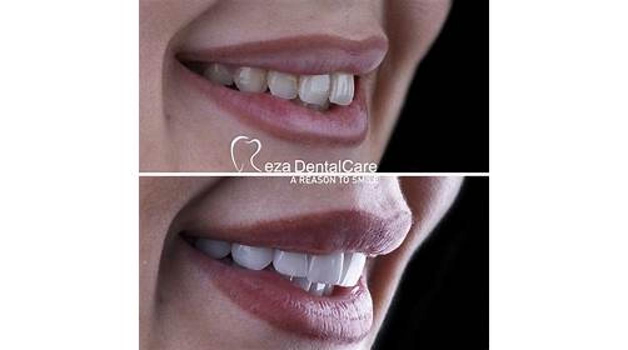 Reza Dental Care - South Gate, CA