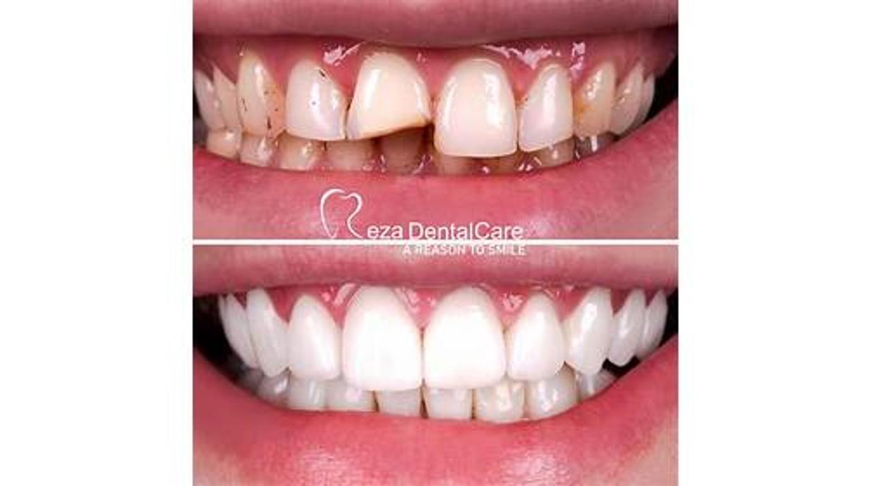 Reza Dental Care - South Gate, CA