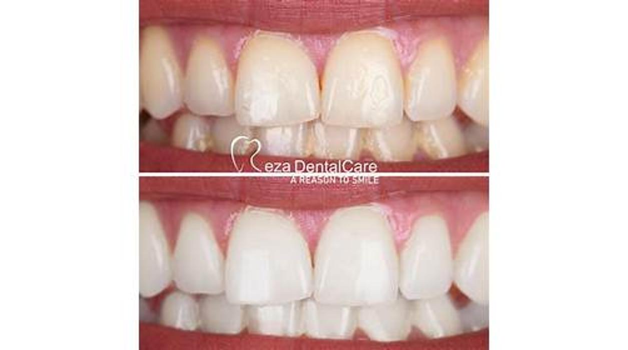 Reza Dental Care - South Gate, CA