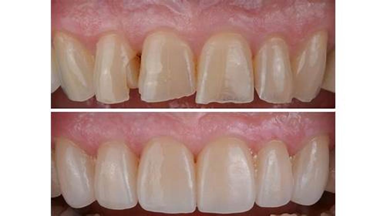 Reza Dental Care - South Gate, CA