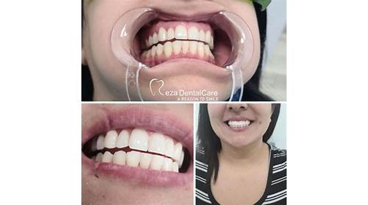 Reza Dental Care - South Gate, CA