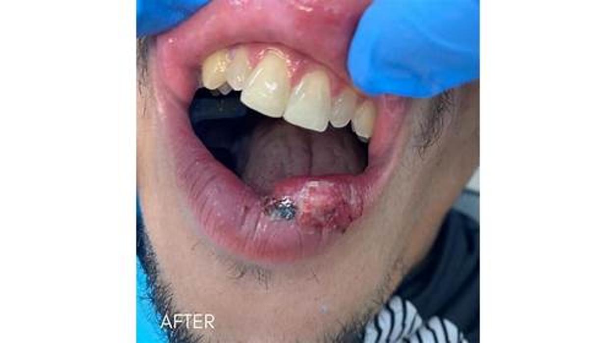 Reza Dental Care - South Gate, CA