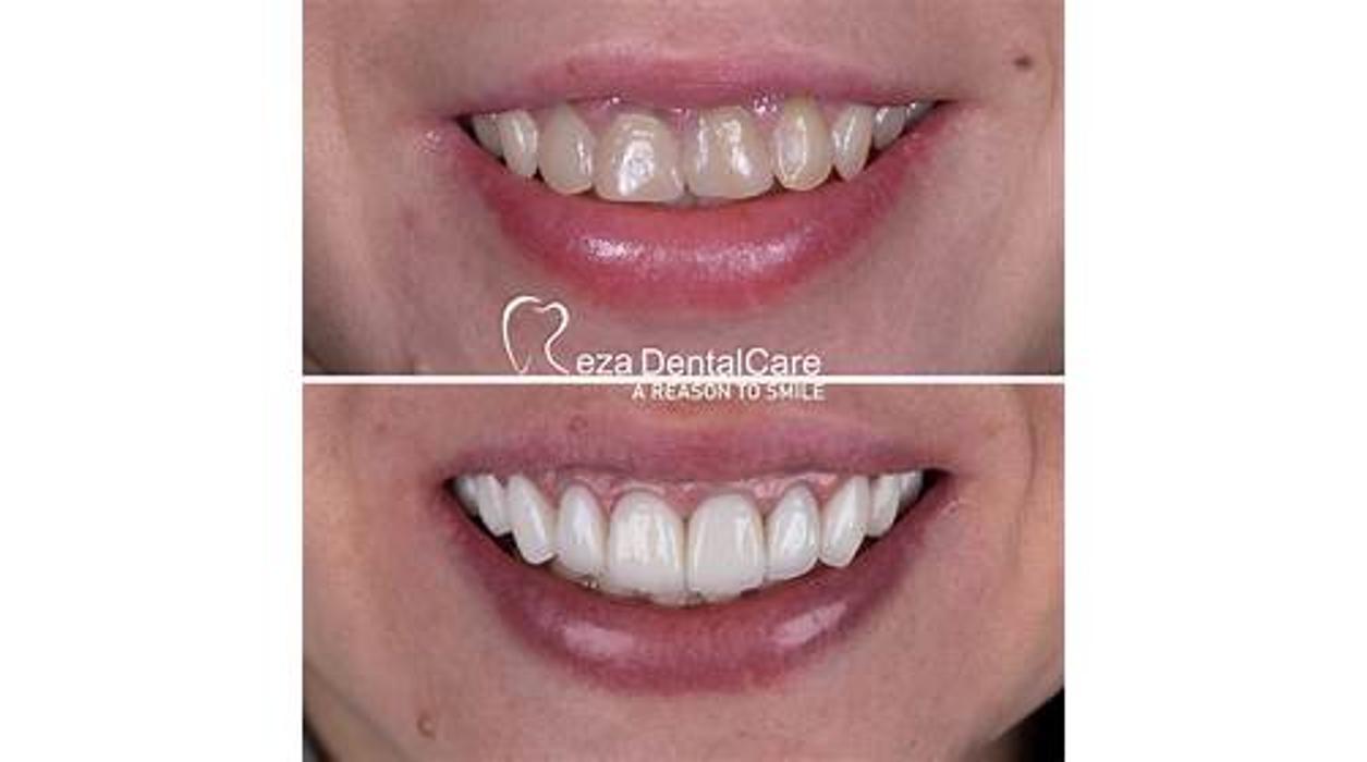 Reza Dental Care - South Gate, CA