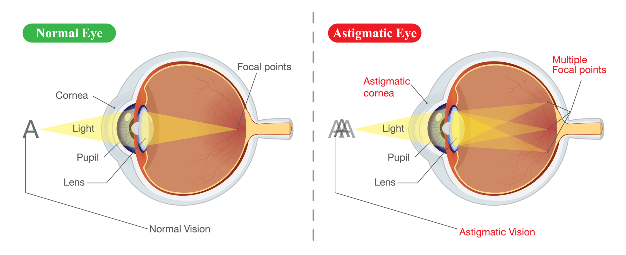 Mission Creek Optometry Kelowna (250)717-0086