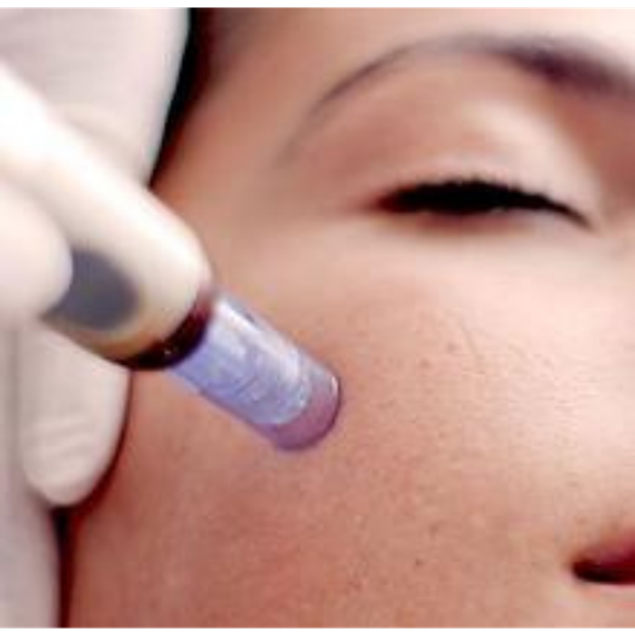 Infinis MD - Newport Beach, CA