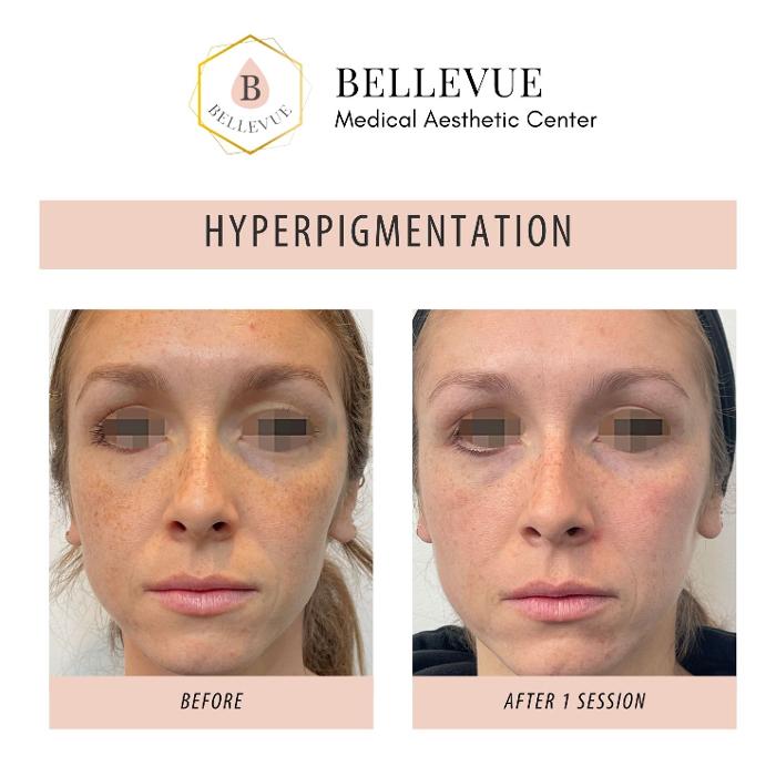 Bellevue Medical Aesthetic Center - Bellevue, WA