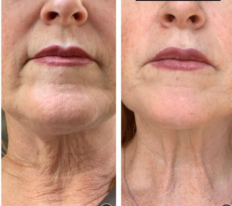 Barrington Back and Body - Barrington, IL