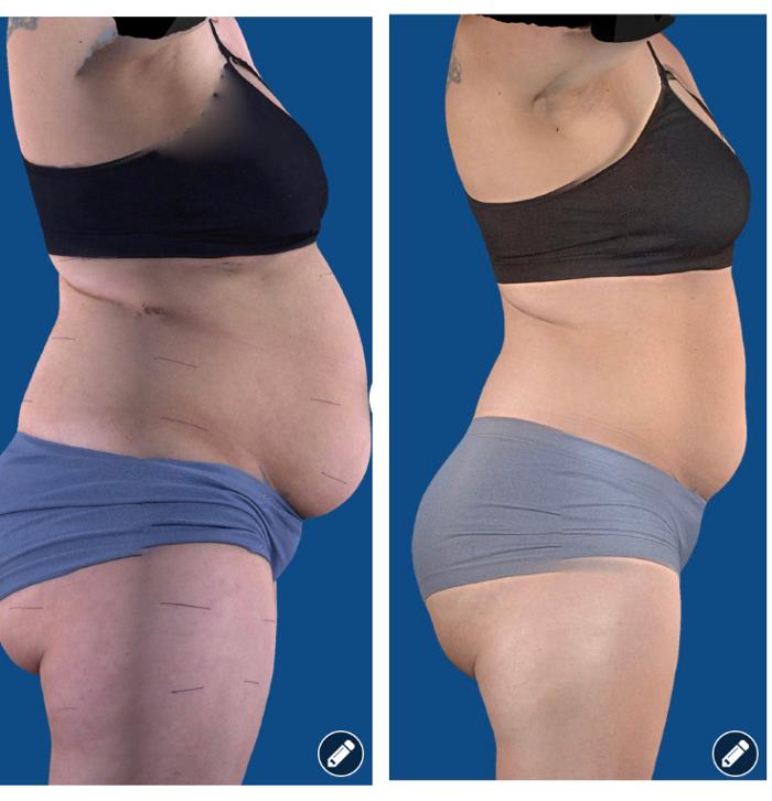 Barrington Back and Body - Barrington, IL