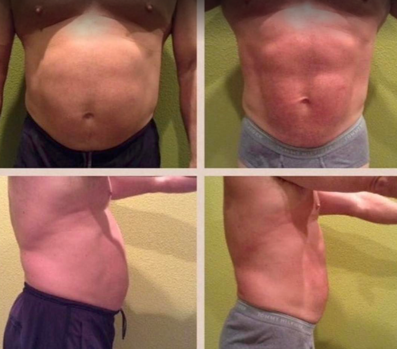 Body Lyft System - Carmel, IN