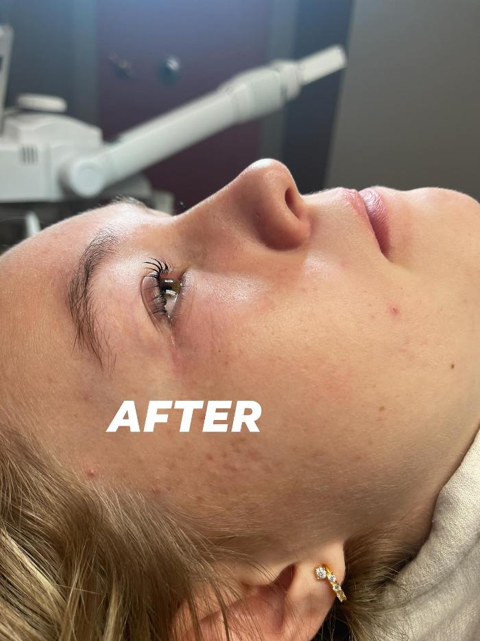 Bare Beauty Aesthetics - Kirksville, MO