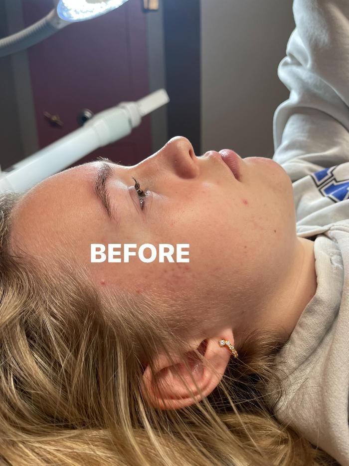 Bare Beauty Aesthetics - Kirksville, MO