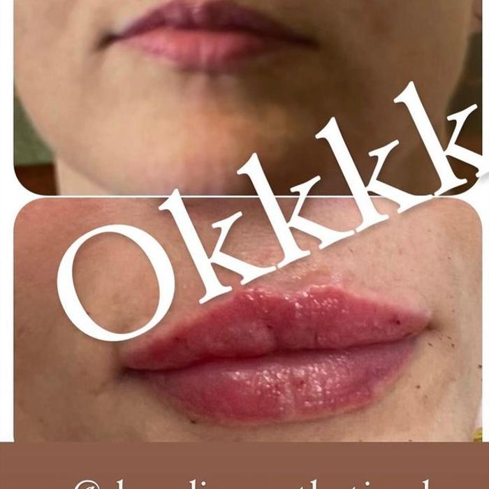 Shoreline Aesthetics - Charleston, SC