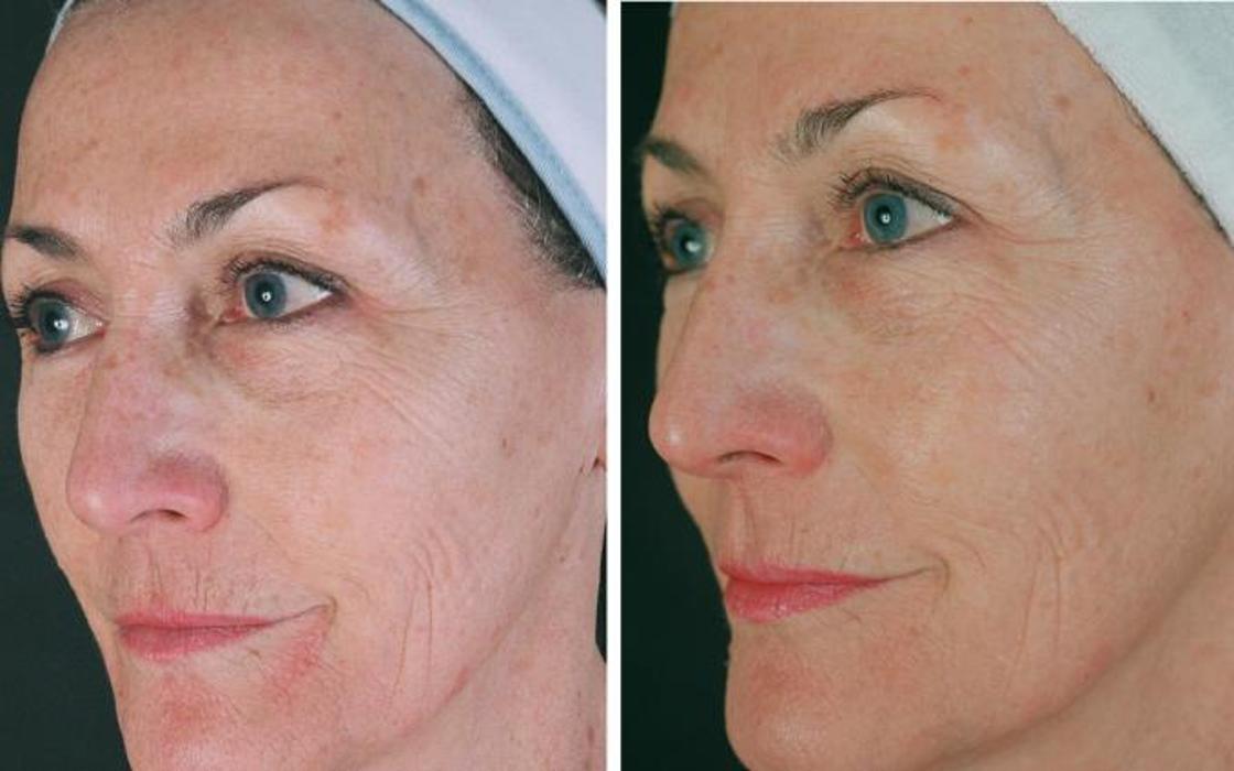 Vogue Laser Clinic - Loveland, CO