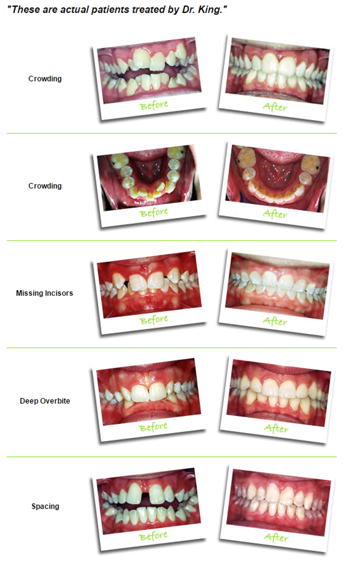 King Orthodontics - Faribault, MN