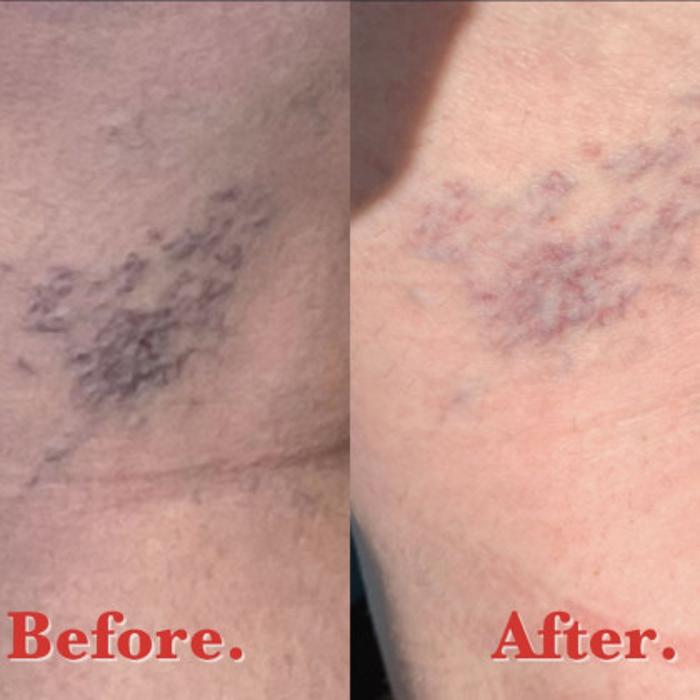 New You Medispa - Howell, NJ