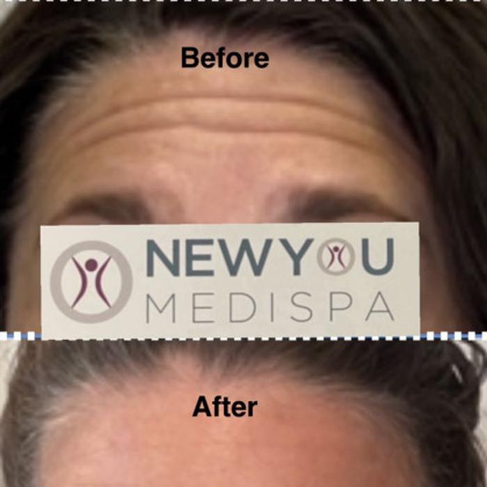 New You Medispa - Howell, NJ