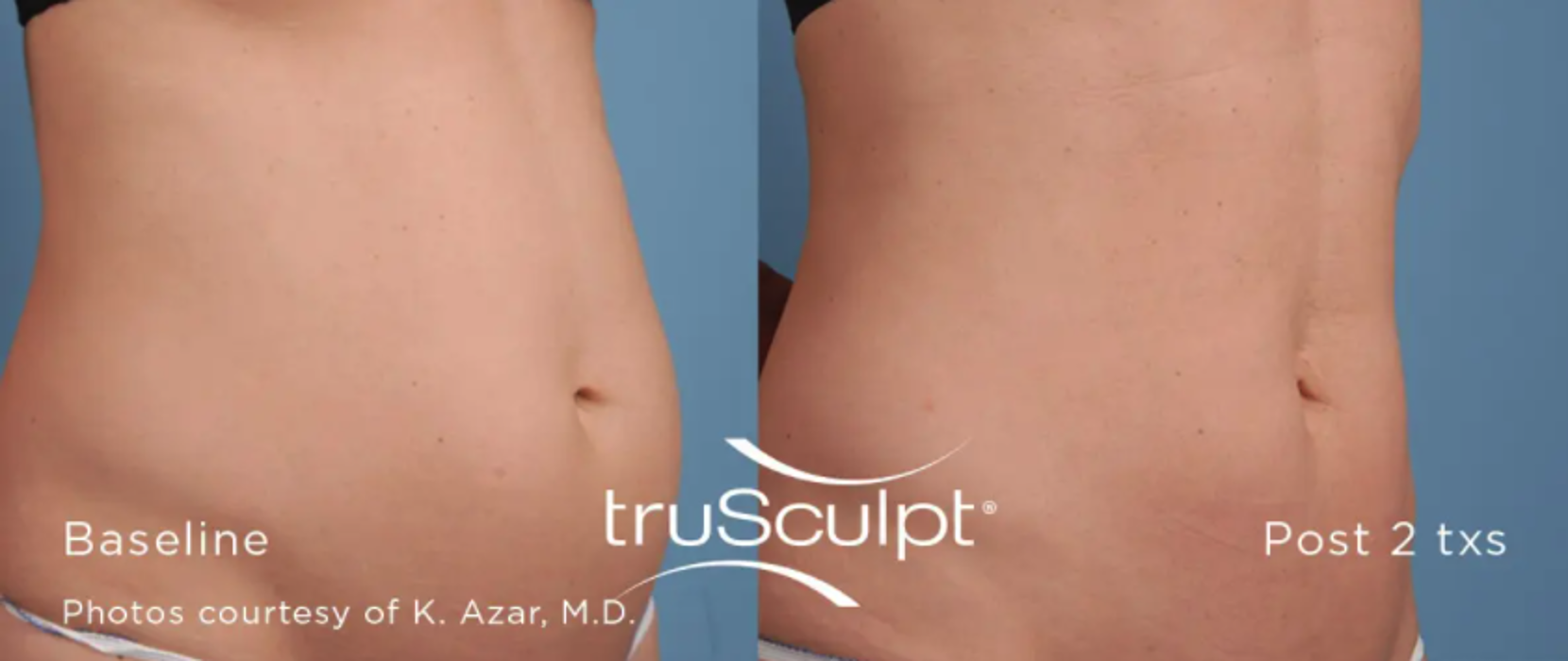 New You Medispa - Howell, NJ
