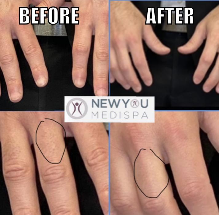 New You Medispa - Howell, NJ