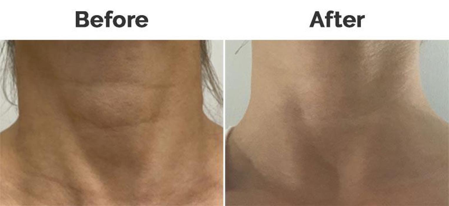 New You Medispa - Howell, NJ