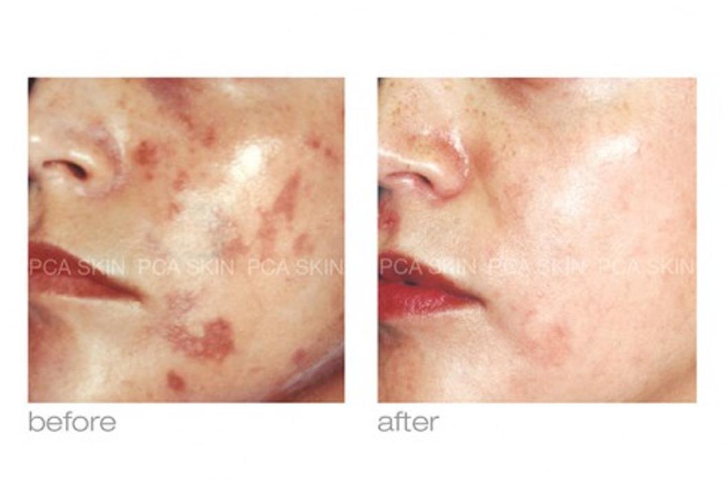 Skin Smart - Lafayette, LA