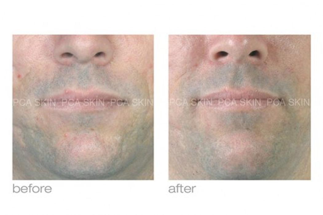 Skin Smart - Lafayette, LA
