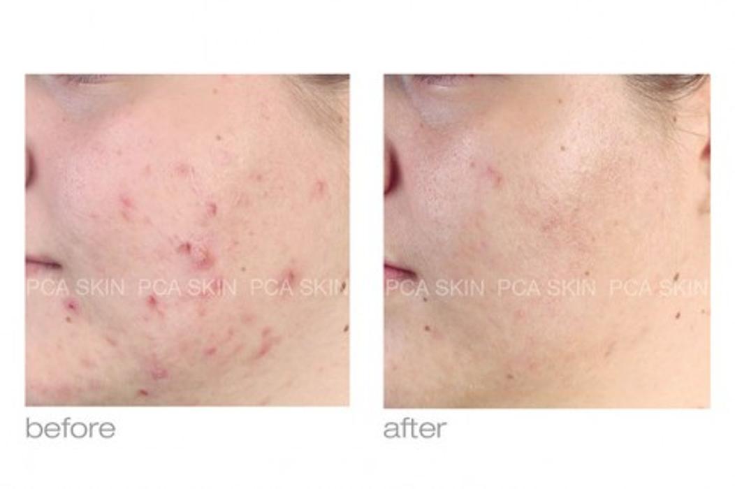 Skin Smart - Lafayette, LA