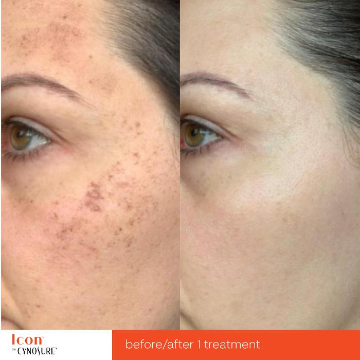 Circadian Rejuvenation - Charlotte, NC