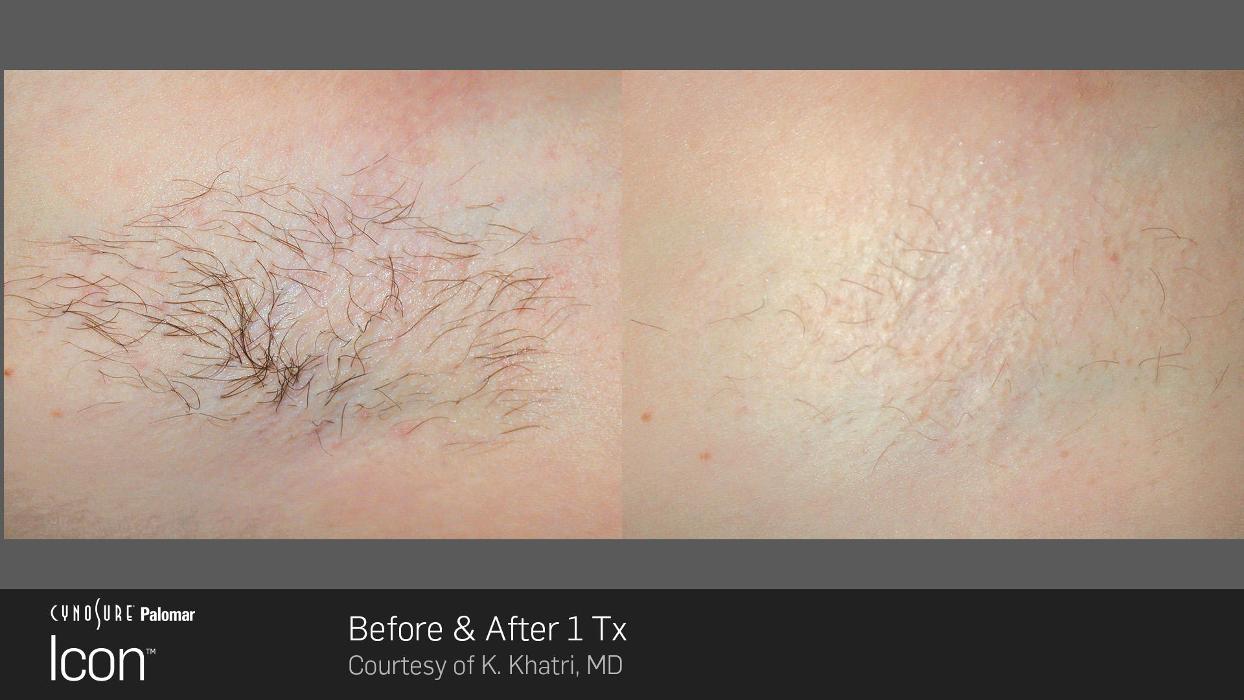 Circadian Rejuvenation - Charlotte, NC