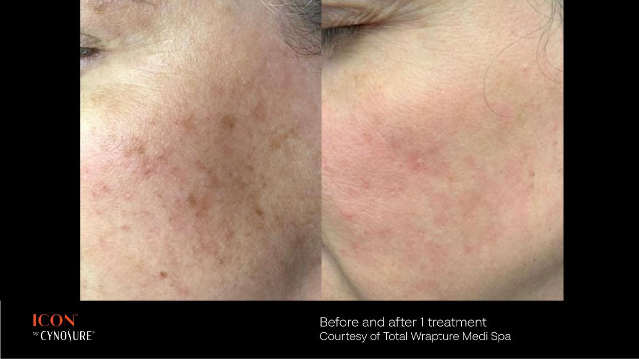 Circadian Rejuvenation - Charlotte, NC