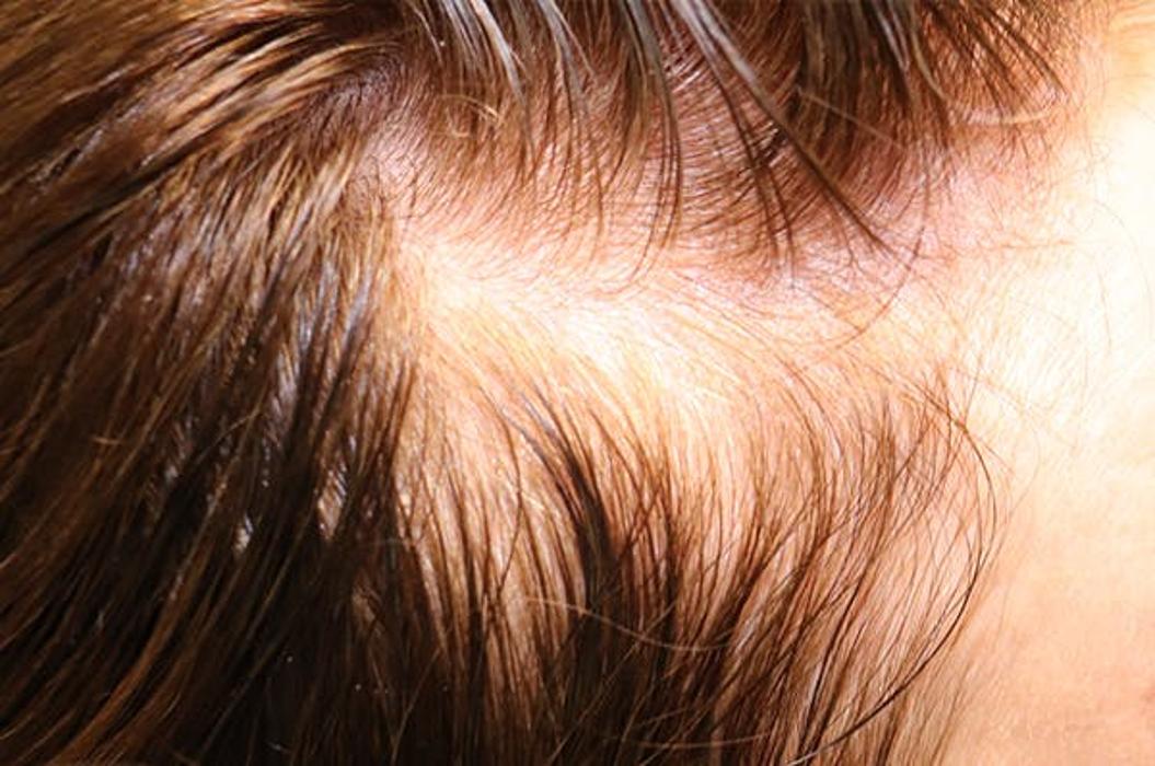 Circadian Rejuvenation - Charlotte, NC