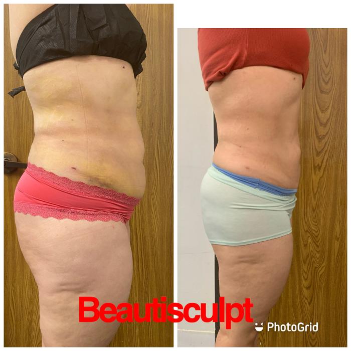 Beautisculpt Studio LLC - Stafford, TX