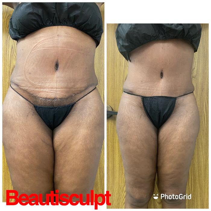 Beautisculpt Studio LLC - Stafford, TX
